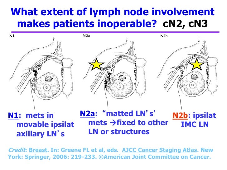 breast cancer and lymph node involvement Sikhism and gays
